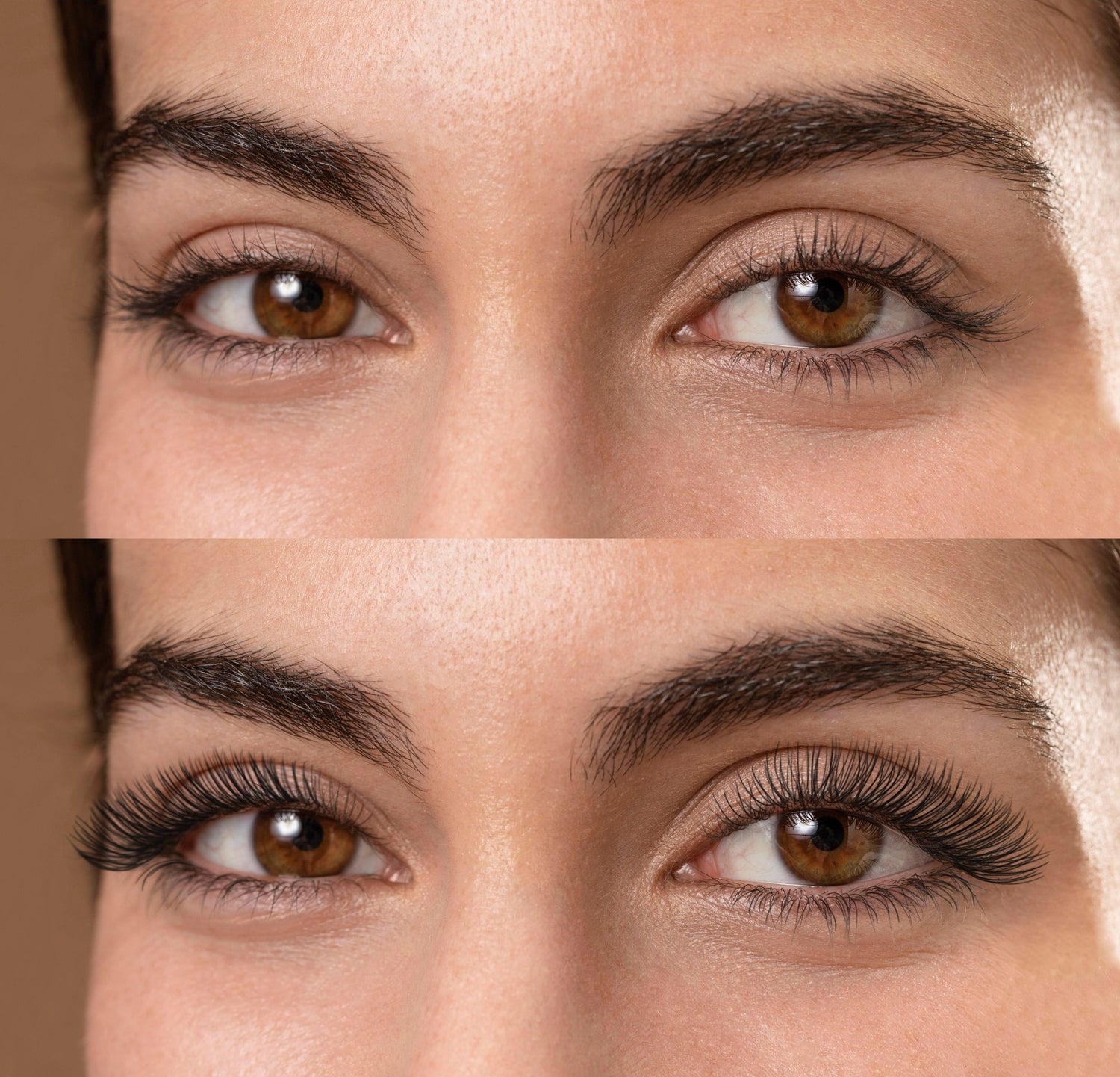Thyroid and Eyelash/Eyebrow Loss – What You Need to Know